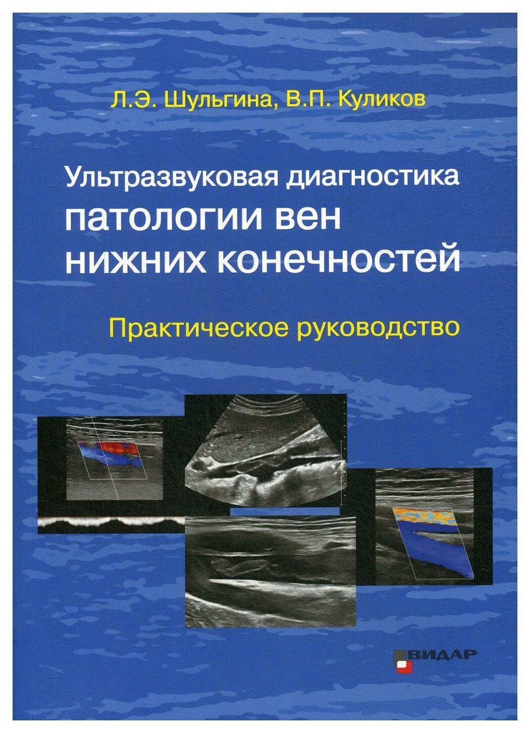 Ультразвуковая диагностика патологии вен нижних конечностей: практическое руководство