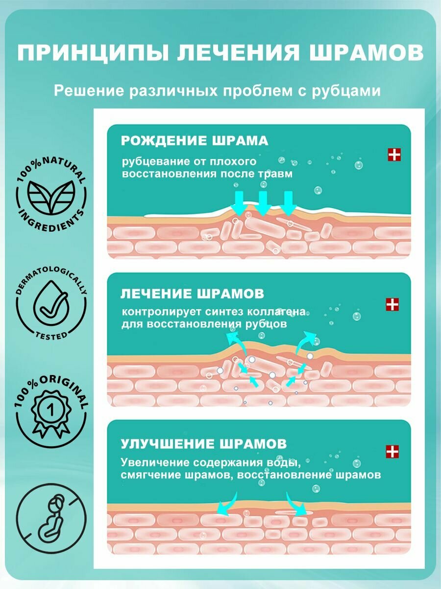 Лекарства От Растяжек Средство от растяжек