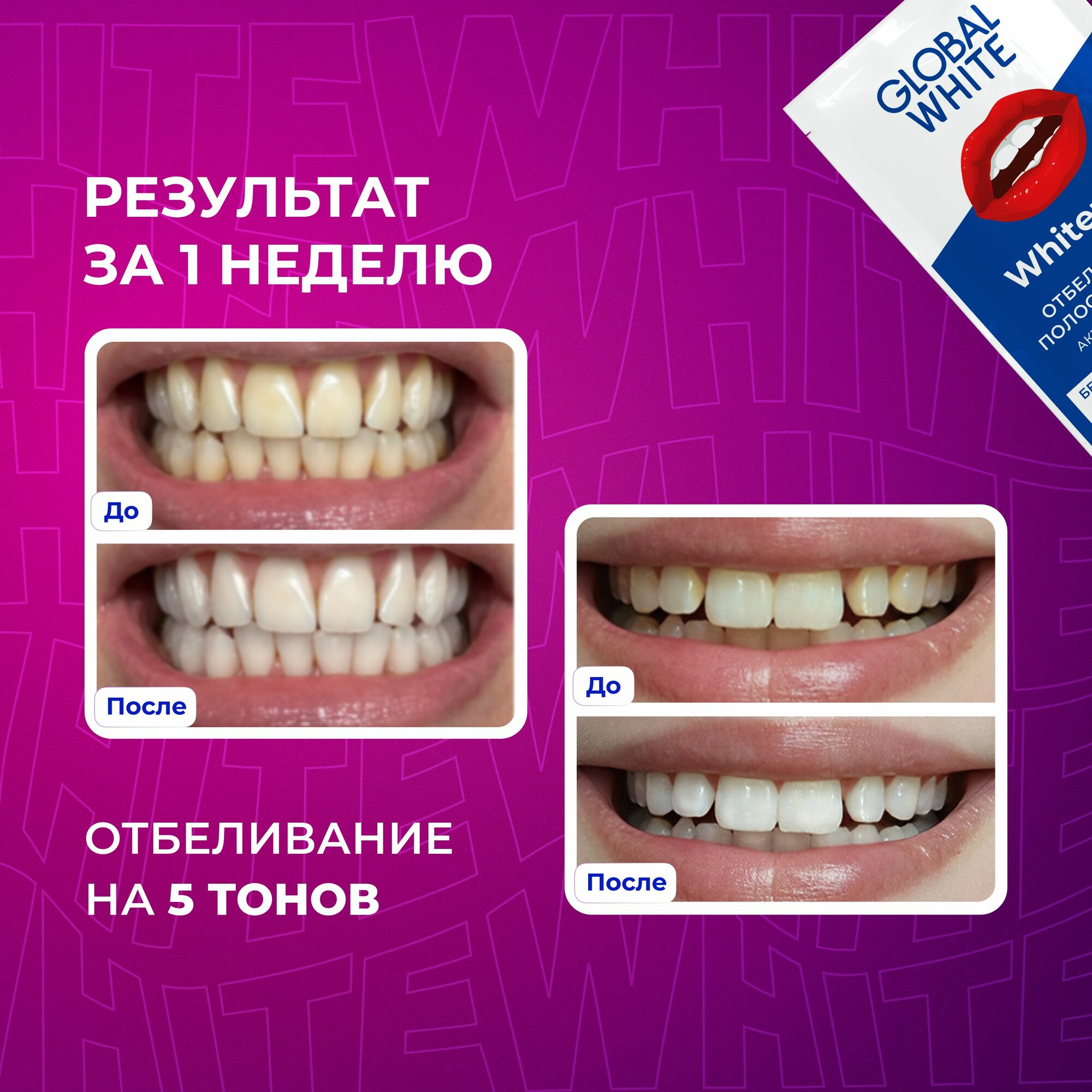 Отбеливающие полоски для зубов Global White с активным кислородом 2 саше / Две пары отбеливающих полосок — фото 1