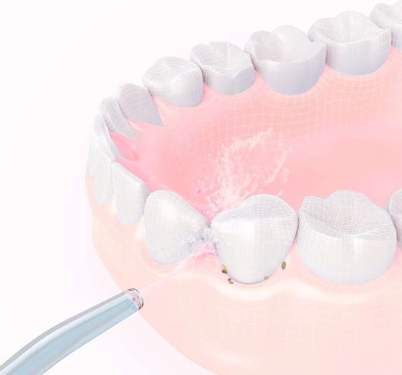 Семейное фото с ирригатором Xiaomi - радость от решения проблемы