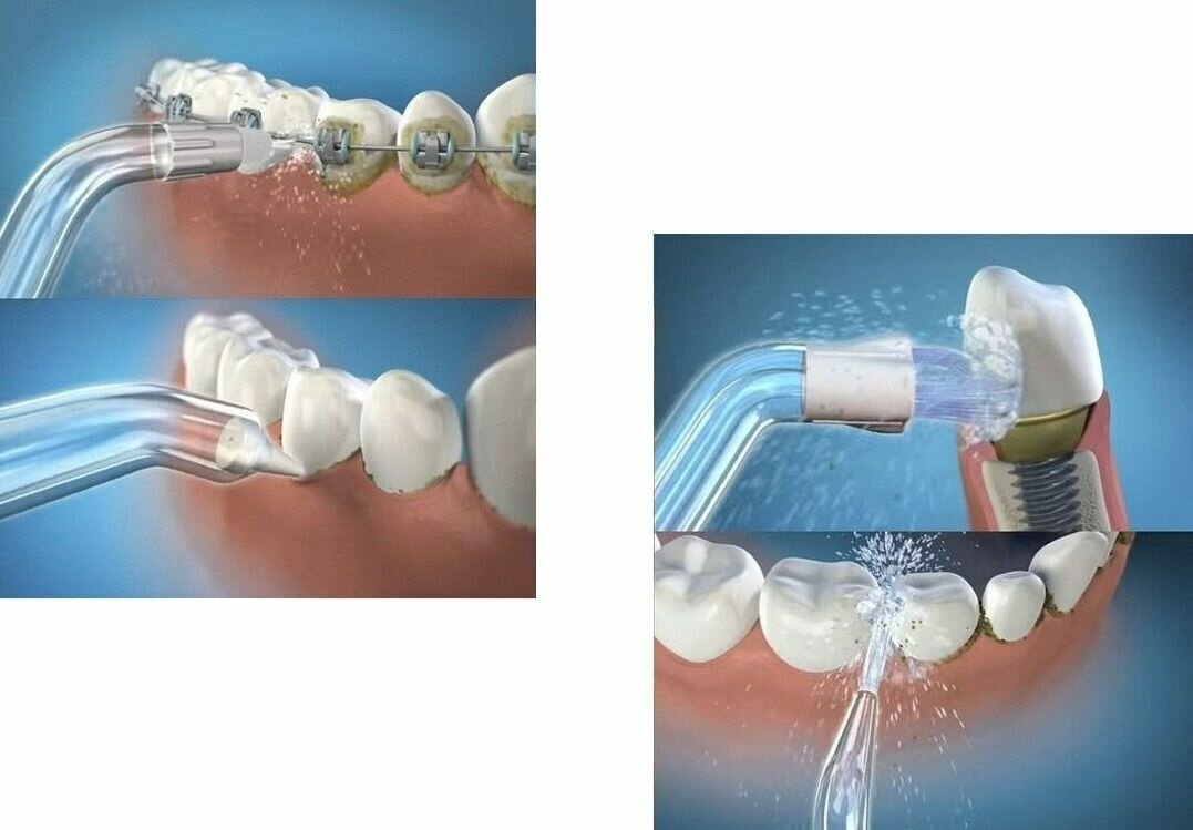 Ирригатор для зубов, для полости рта, 3 режима работы, зарядка через USB, 4 насадки белый - фотография № 3