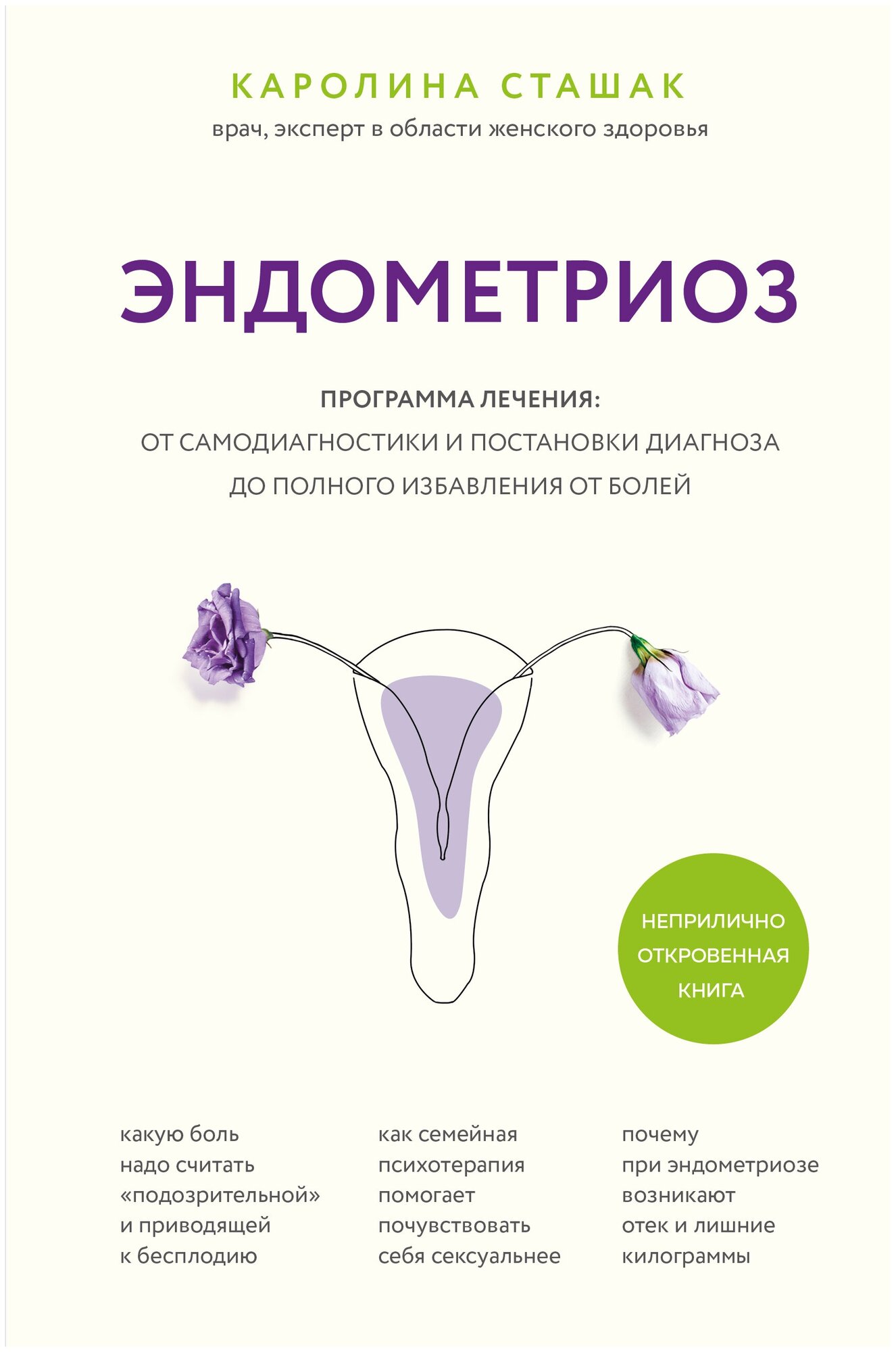 Эндометриоз. Программа лечения: от самодиагностики и постановки диагноза до полного избавления от болей - фото №15