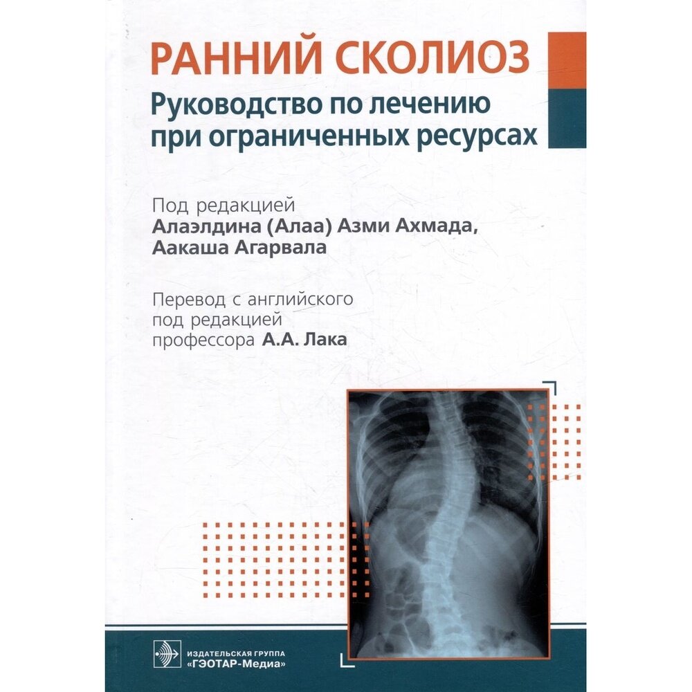 Ранний сколиоз. Руководство по лечению при ограниченных ресурсах - фото №2