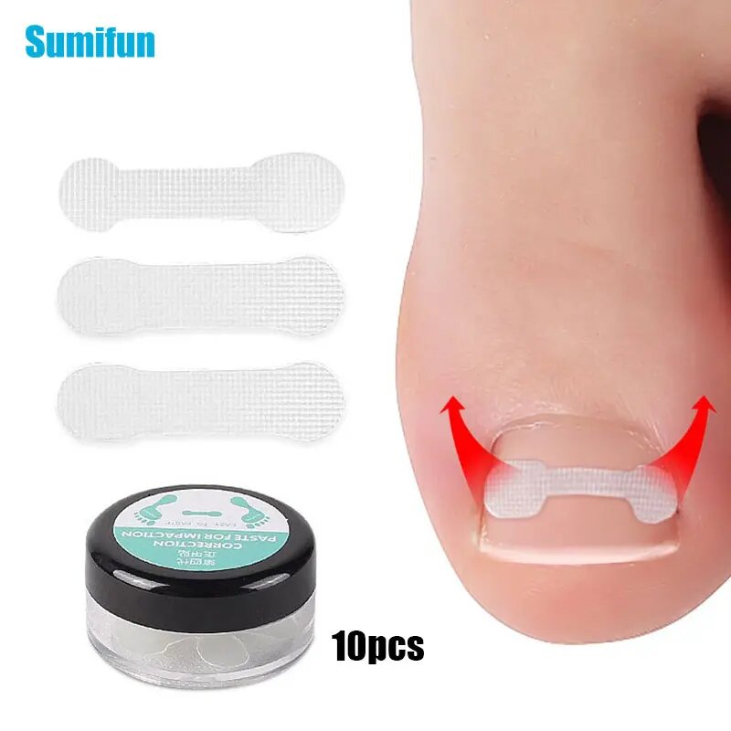 Набор для коррекции вросших ногтей Sumifun, 10 шт.