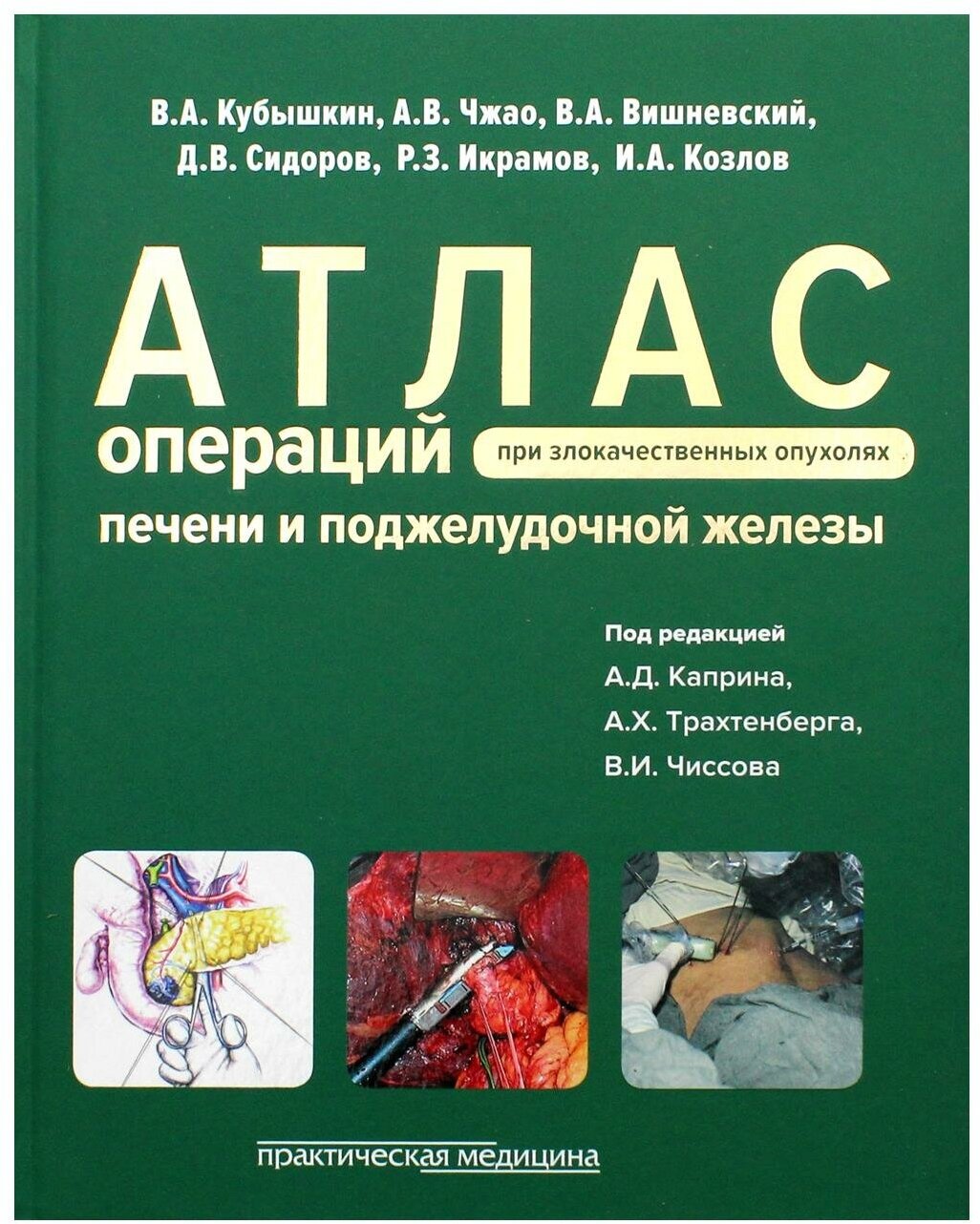 Атлас операций при злокачественных опухолях печени и поджелудочной железы (билиопанкретодуоденальной зоны)