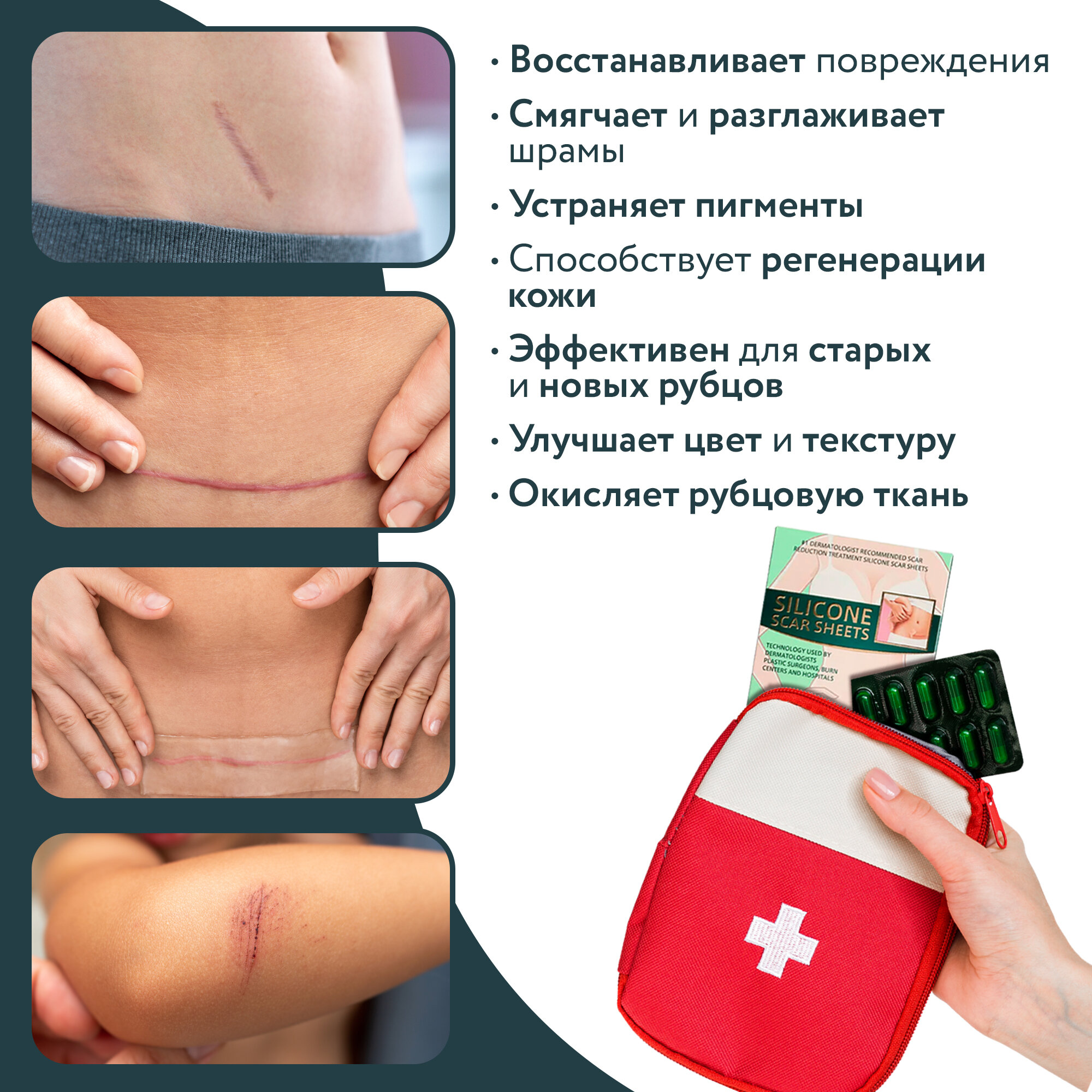 Изображение Пластырь силиконовый от шрамов и рубцов OZBERRY. 4 шт 3,5х7,5см. Заживляющий послеоперационный пластырь от растяжек