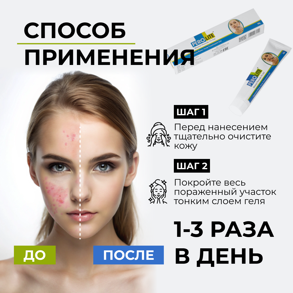 Гель от акне, прыщей и черных точек с бензоил пероксидом 5% перолайт, 30 гр — фото 1