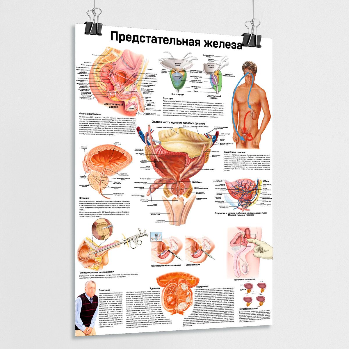 Обучающий медицинский плакат "Предстательная железа" / А-2 (42x60 см.)