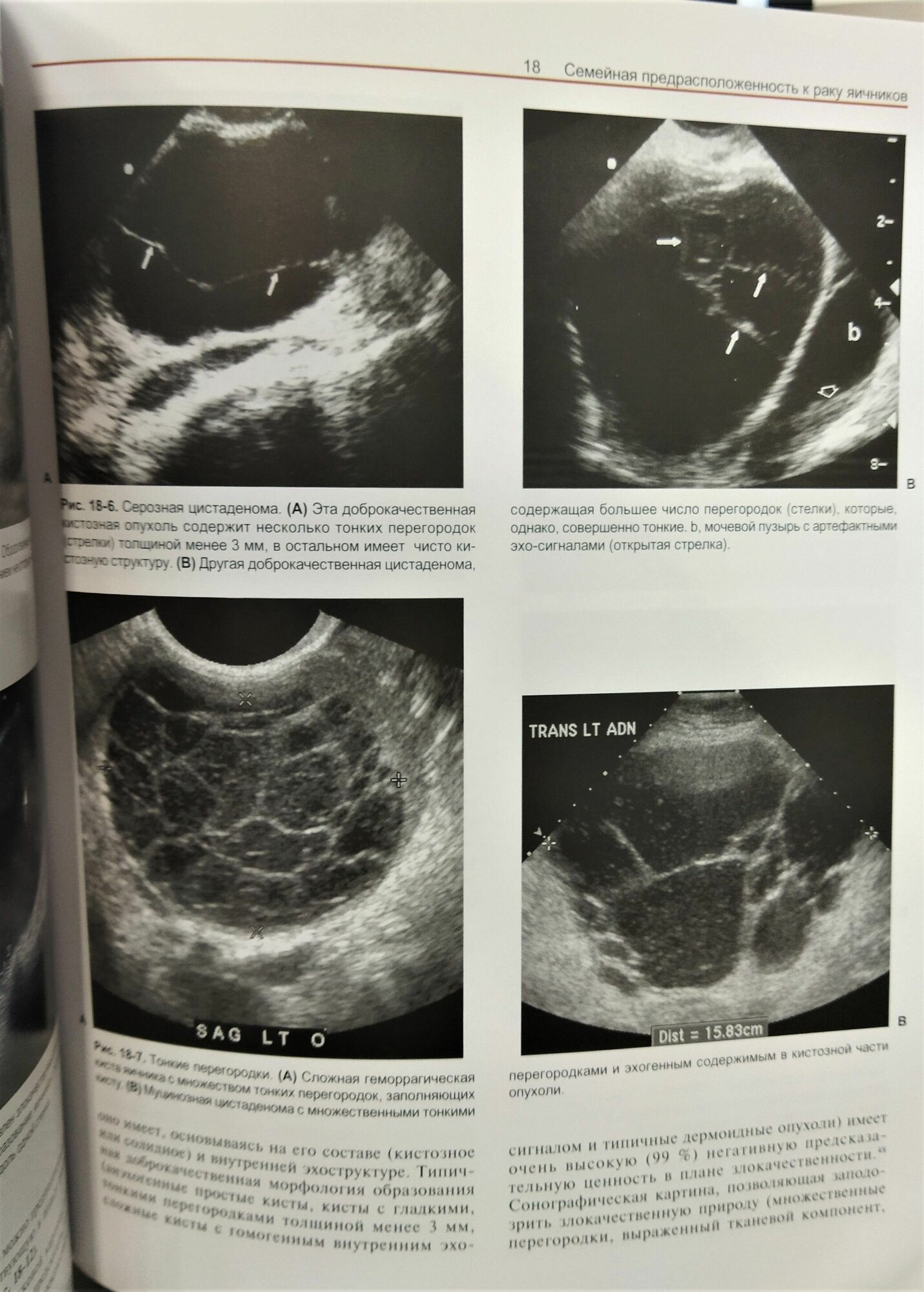 Ультразвуковая диагностика. Практическое решение клинических проблем. Том 2 - фото №4