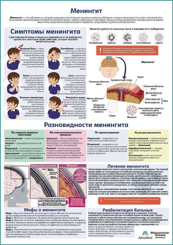 Менингит медицинский плакат, матовый холст от 200 г/кв. м, размер A1+
