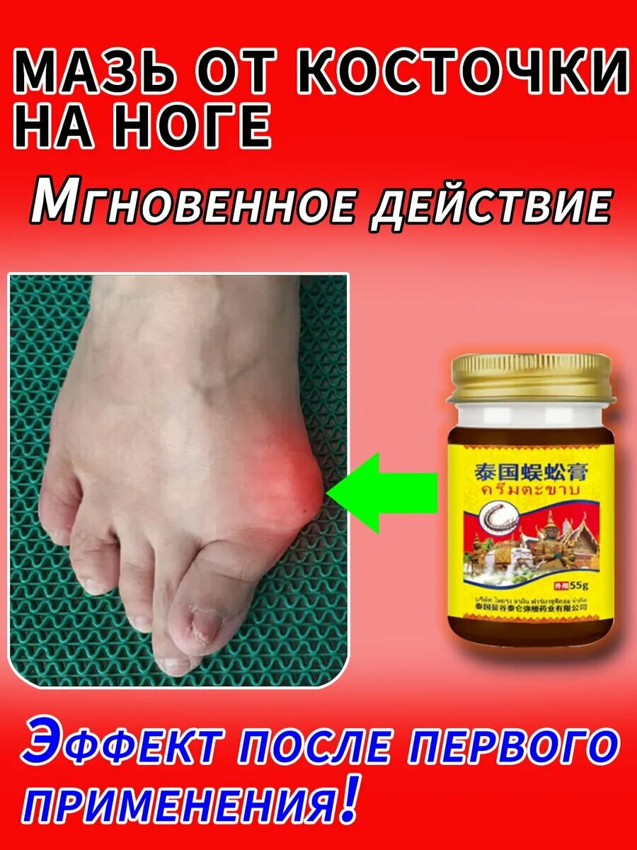 Мазь от косточки на ноге  лечение вальгуса и подагры