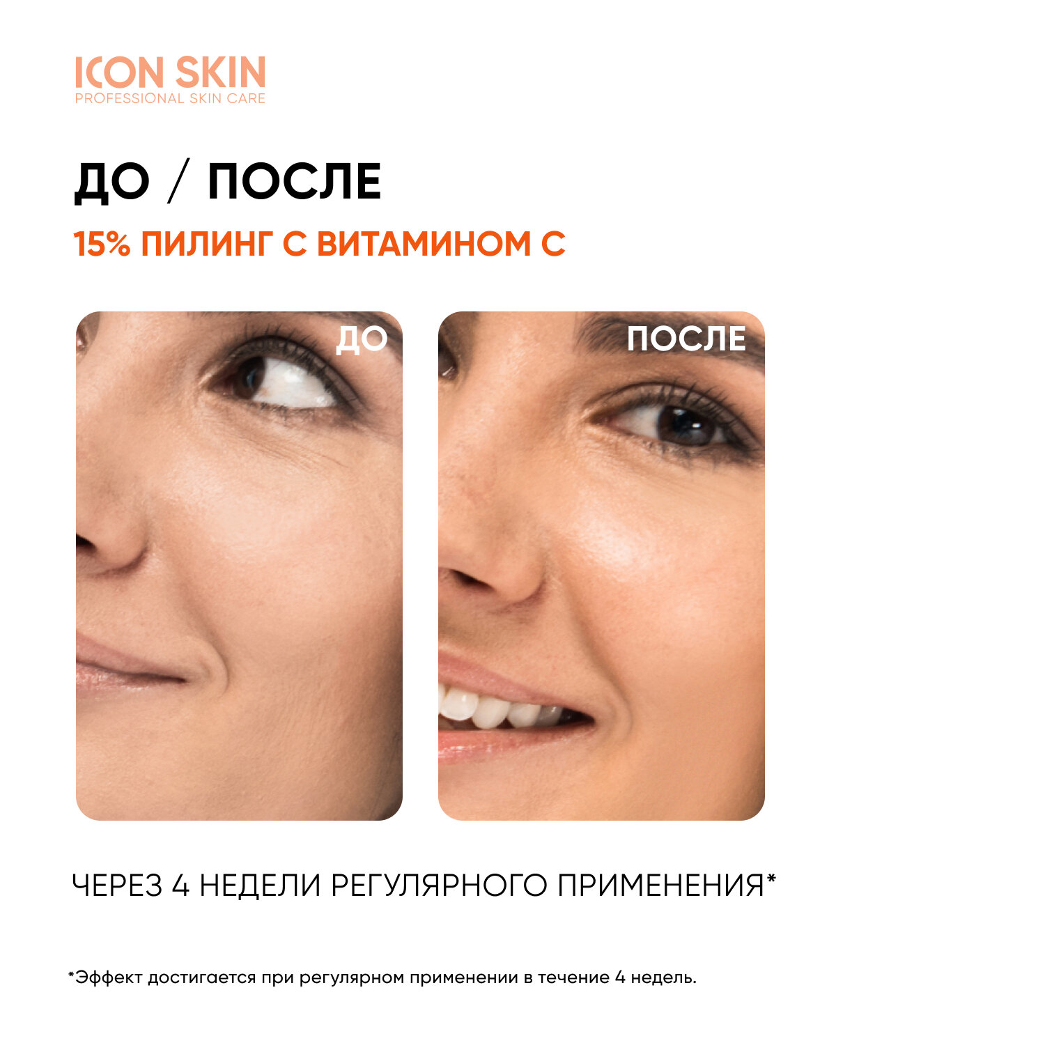 ICON SKIN Пилинг с витамином С с 15% комплексом кислот для всех типов кожи лица, 30 мл