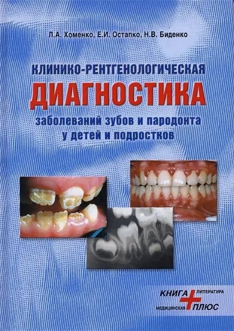 Клинико-рентгенологическая диагностика заболеваний зубов и парадонта у детей и подростков