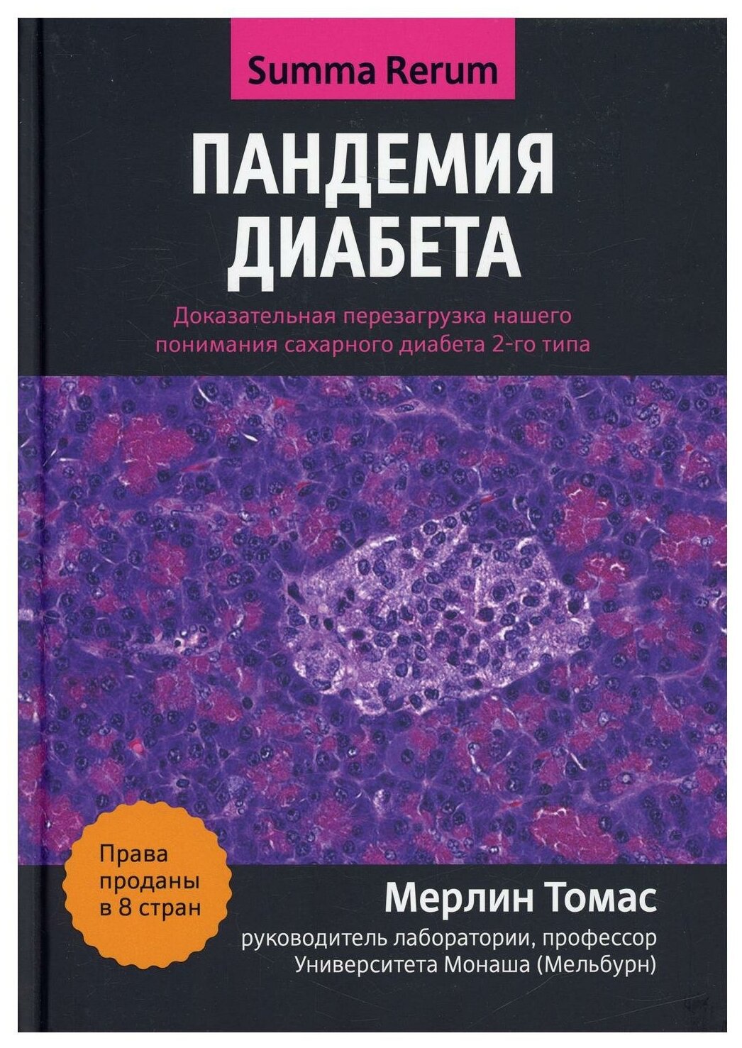 Пандемия диабета. Доказательная перезагрузка нашего понимания сахарного диабета 2-го типа - фото №1