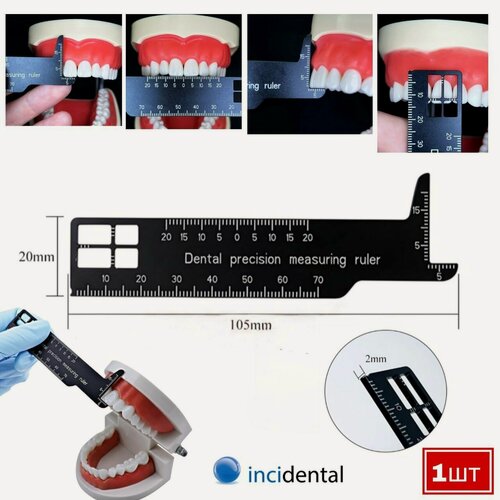 Изображение товара Линейка стоматологическая ортодонтическая , Инсидентал . Измерения аномалии положения группы зубов в сагиттальной и трансверзальной плоскости, уровень перекрытия и разобщения . от Incidental .
