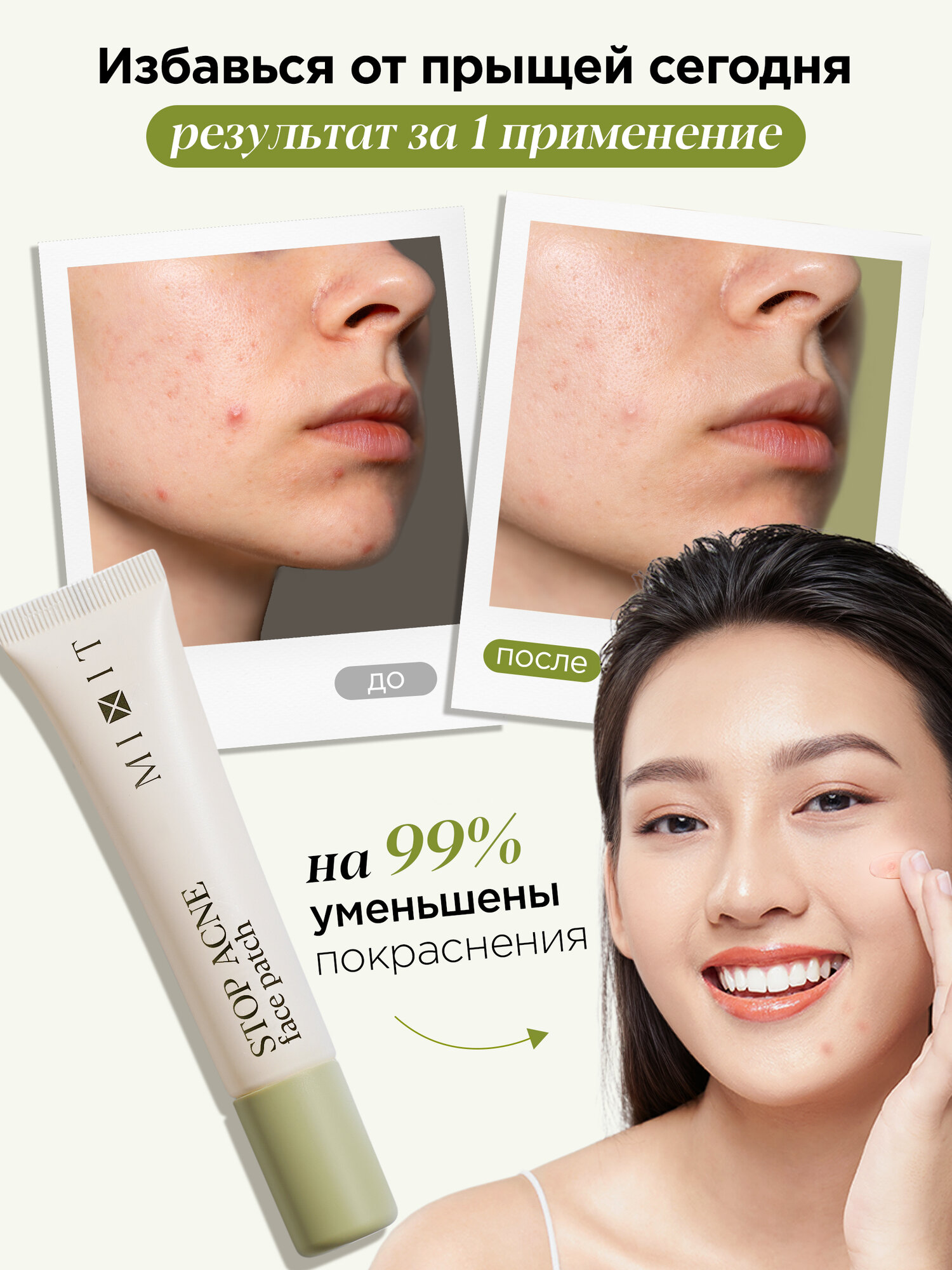 MIXIT Патч Stop Acne Face Patch, с кислотами, против прыщей, 15мл — фото 1