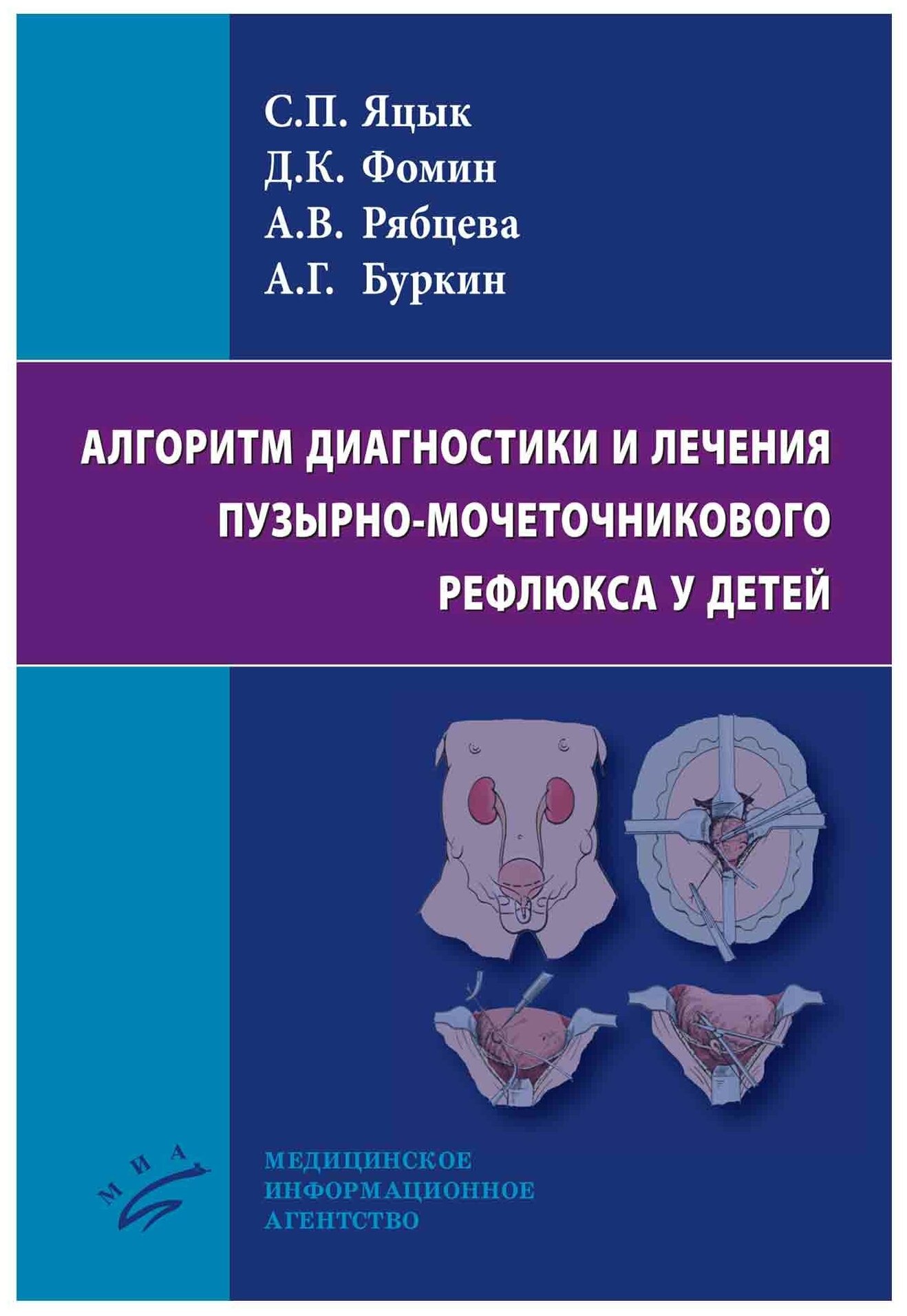 Алгоритм диагностики и лечения пузырно-мочеточникового рефлюкса у детей - фото №1