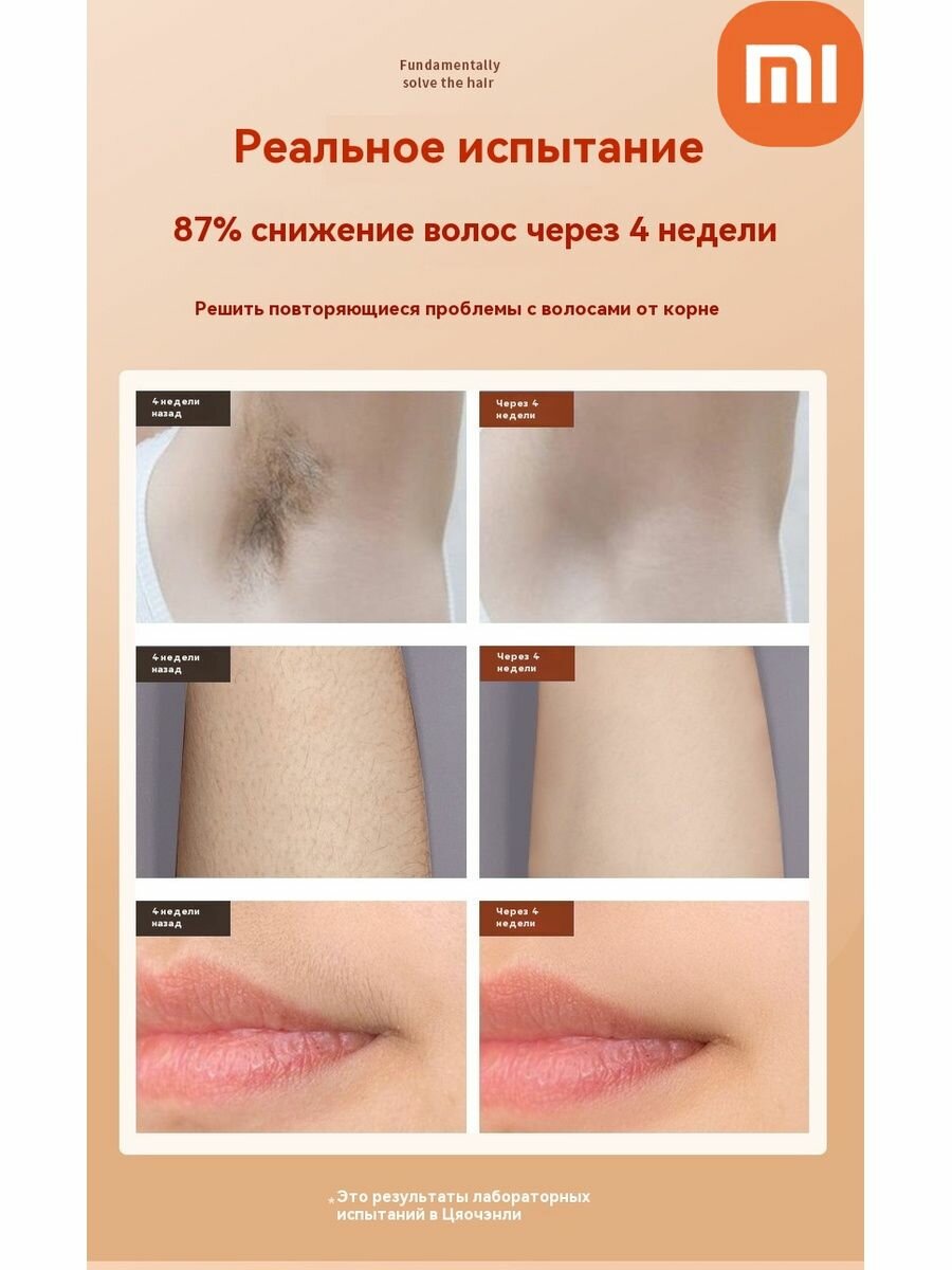 Картинки Xiaomi Лазерный инструмент для удаления волос-Праздничные подарки