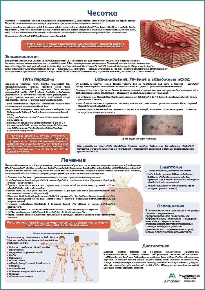 Чесотка медицинский плакат, глянцевая фотобумага от 200 г/кв. м, размер A1+