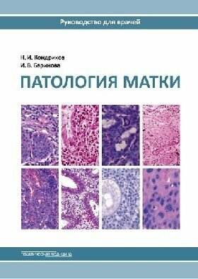 Кондриков Н. И, Баринова И. В. "Патология матки: руководство для врачей. 2-е изд."