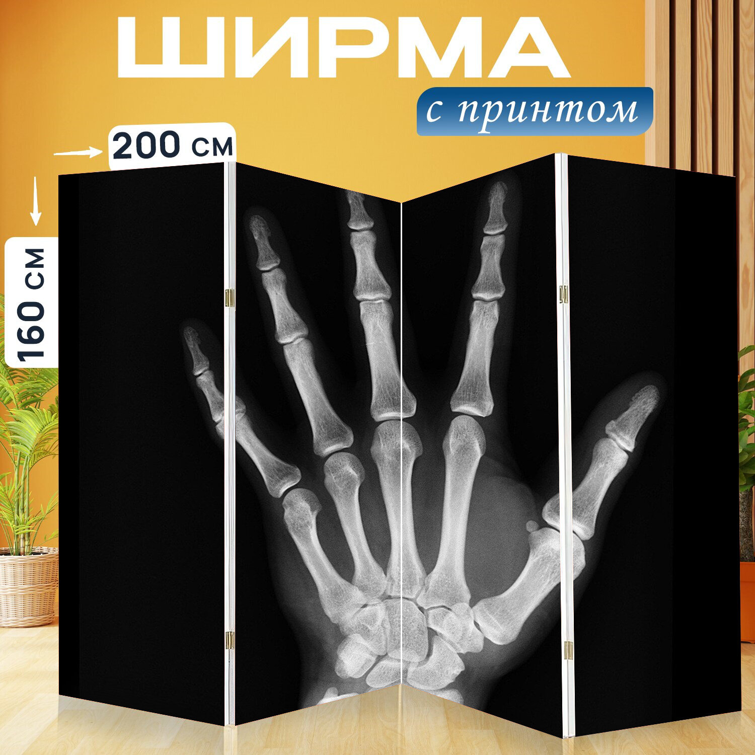 Ширма перегородка с принтом "Рентгеновский, медицинское лечение, рука" на холсте - 200x160 см. для зонирования, раскладная