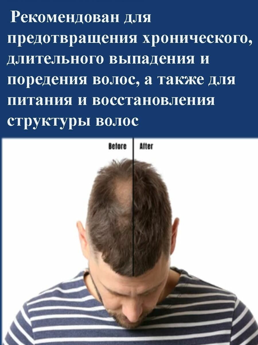 Набор Шампунь и бальзам против перхоти и выпадения волос — фото 1