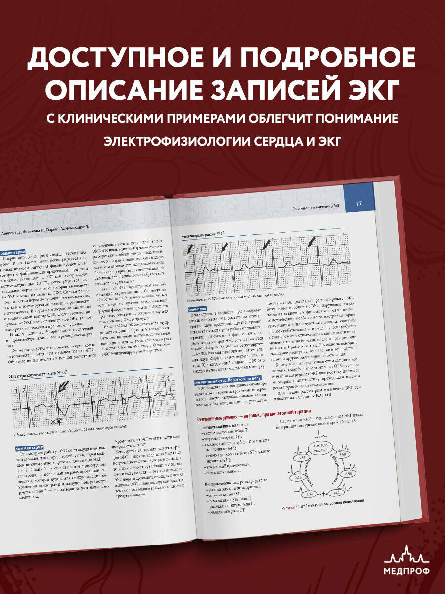 Новикова Н. А, Чомахидзе П. Ш, Андреев "Атлас электрокардиографии. Интерпретация результатов: от простого к сложному"