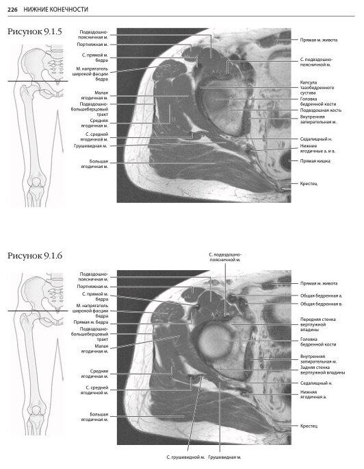 МРТ и КТ. Секционная анатомия (Марк В. Андерсон, Майкл Дж. Фокс) - фото №2
