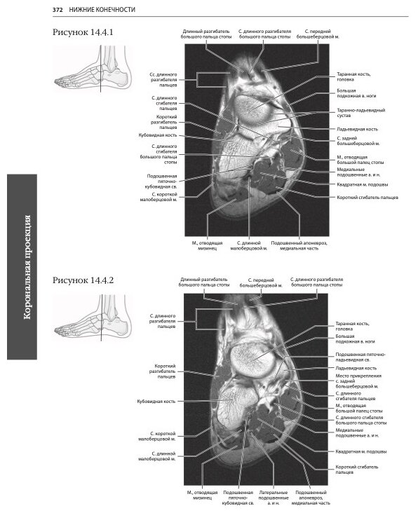 МРТ и КТ. Секционная анатомия (Марк В. Андерсон, Майкл Дж. Фокс) - фото №9