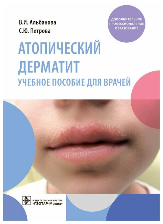 Атопический дерматит : учебное пособие для врачей