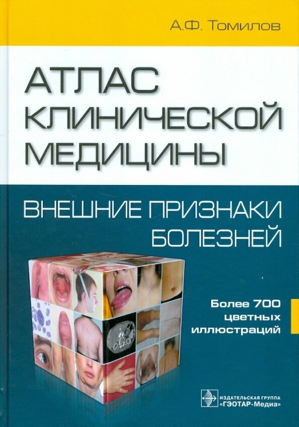 Атлас клинической медицины: Внешние признаки болезней - фото №8