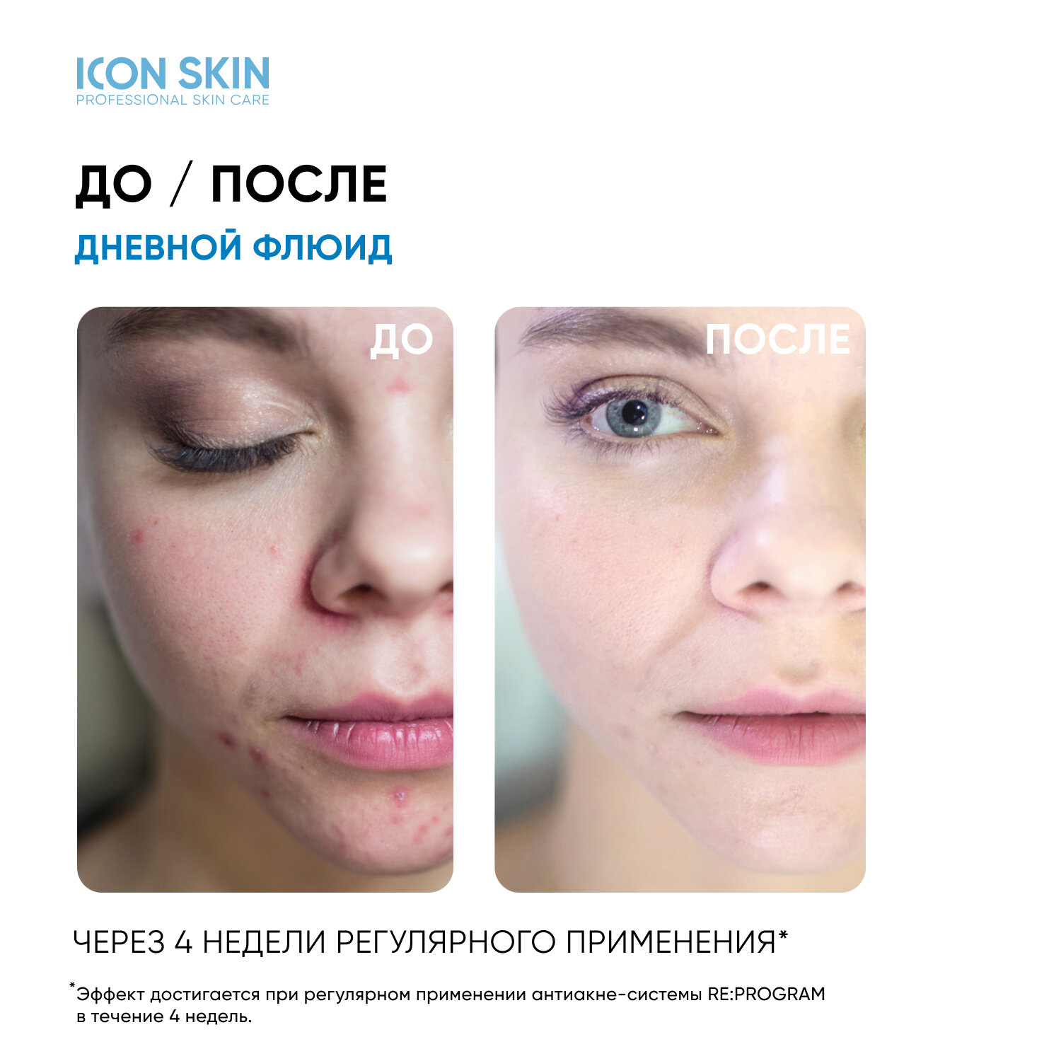 ICON SKIN / Матирующий дневной крем-флюид Matte & Care для жирной кожи c эффектом пудры, 30 мл