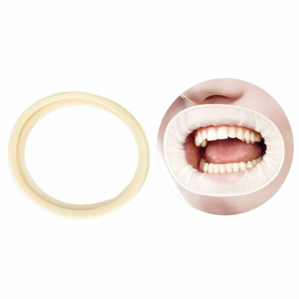Ретрактор стоматологический, Ретракторы губ от NeoHealth ( ОптраГейт бежевый)Размер : 87mm*87mm , Набор : уп : 4 шт