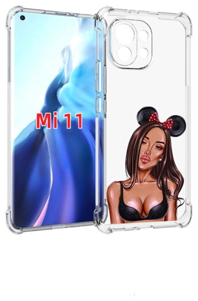 Чехол MyPads девушка-в-купальнике-с-ушками женский для Xiaomi Mi 11 (экран 6.81) задняя-панель-накладка-бампер