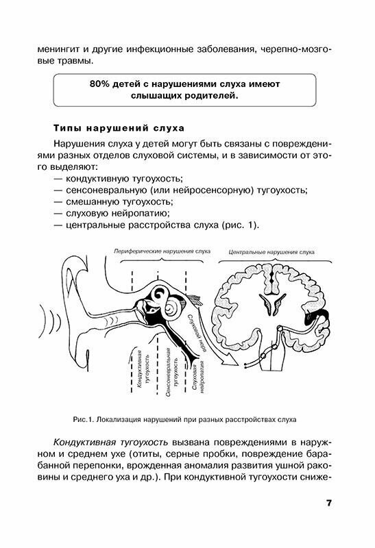 Дети с нарушениями слуха в условиях инклюзии. Пособие для педагогов и воспитателей - фото №10