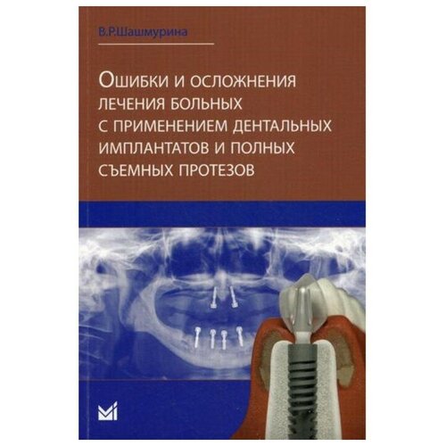 Шашмурина В.Р. "Ошибки и осложнения лечения больных с применением дентальных имплантов и полных съемных протезов"