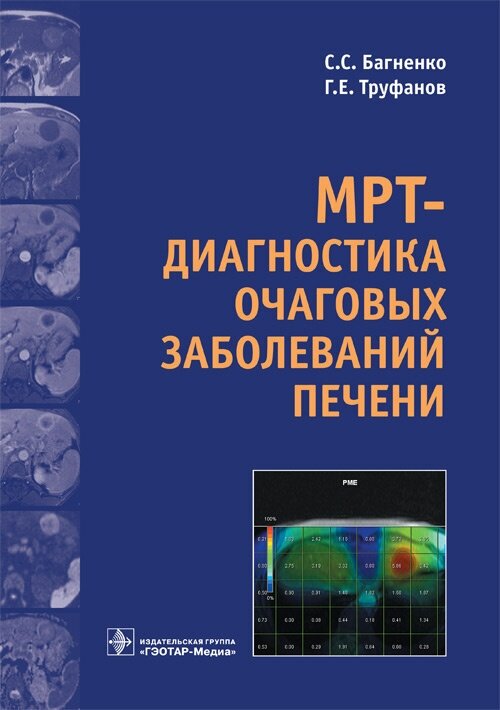 МРТ-диагностика очаговых заболеваний печени - фото №2