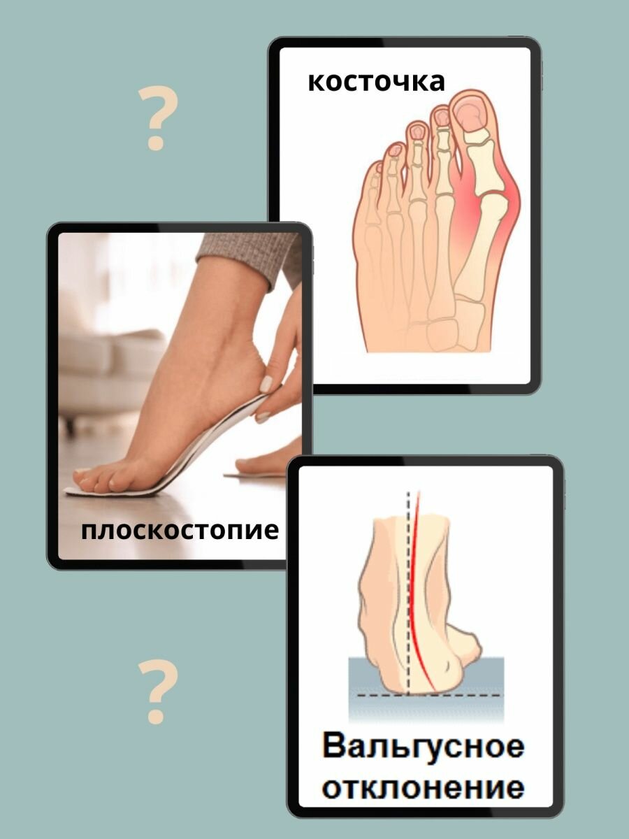 Массажер для ног при плоскостопии - фотография № 2