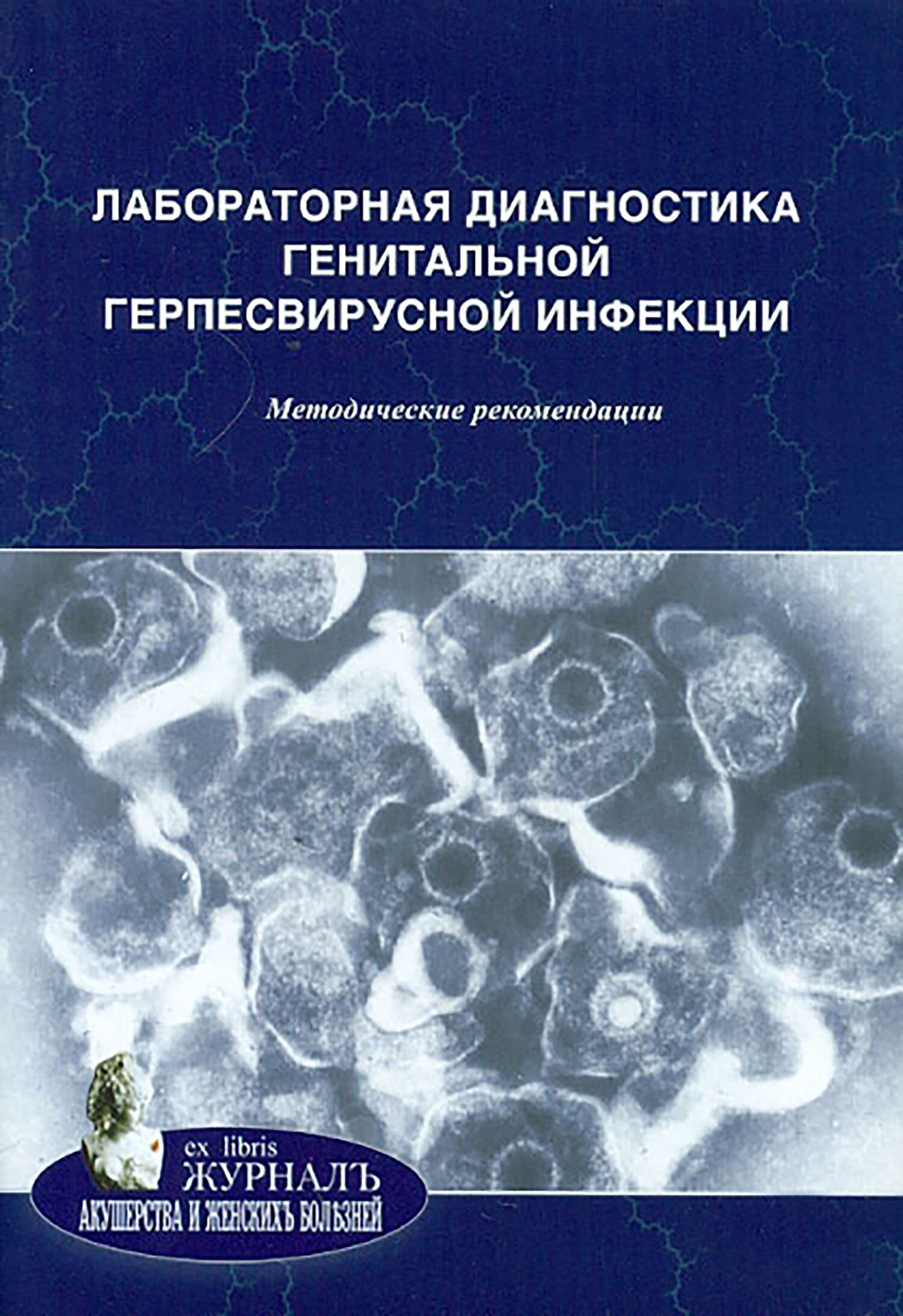 Лабораторная диагностика генитальной герпесвирусной инфекции. Методические рекомендации - фото №2