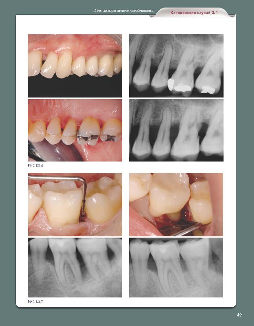 Регенеративные технологии в стоматологии. Научно-практическое руководство - фото №8
