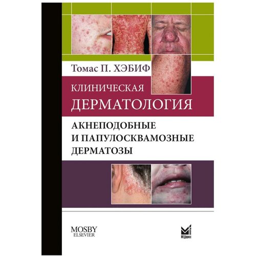 Клиническая дерматология. Акнеподобные и папулосквамозные дерматозы.