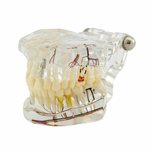 Демонстрационная модель Revyline ТМ-115 Зубы демонстрационная модель зубов с 2 имплантатами съемная модель mandibular overdenture модель некачественных зубов