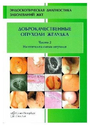 Кузин М. Н, Добронец В. В. "Доброкачественные опухоли желудка. Часть 2. Неэпителиальные опухоли"