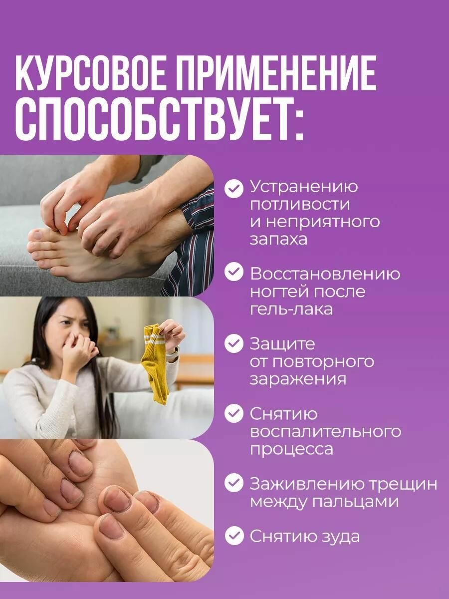 Крем гель от грибка ногтей на ногах, противогрибковое средство для ногтей, мазь против грибка Алтея, Экзифол, 30 мл — фото 1