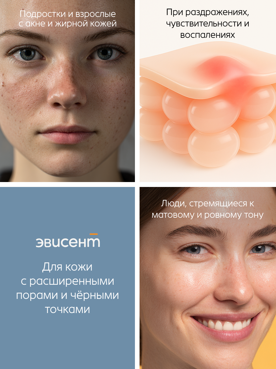Лосьон Эвисент Anti-Acne, для проблемной кожи, без спирта, с дозатором, 150 мл — фото 1