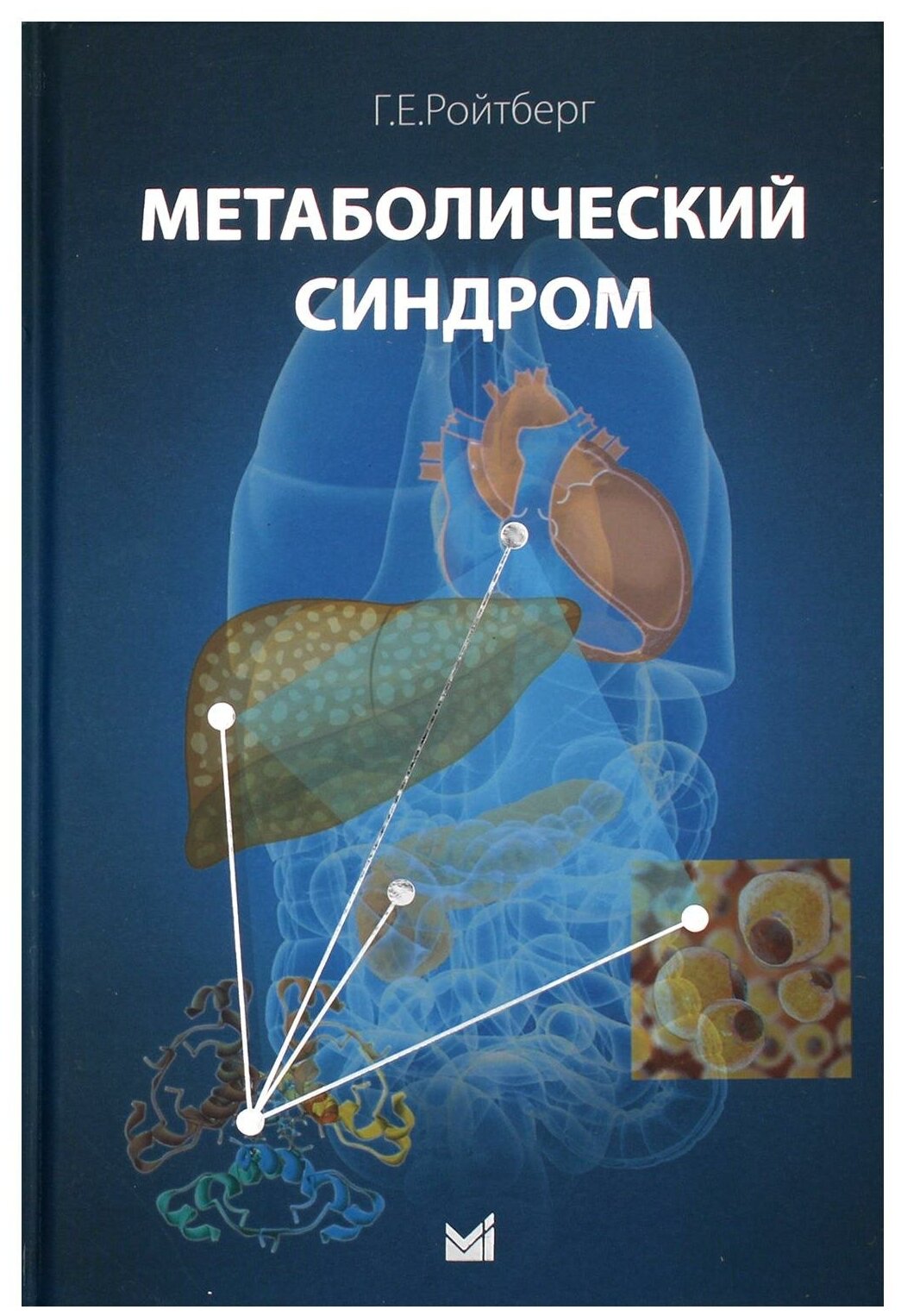 Метаболический синдром