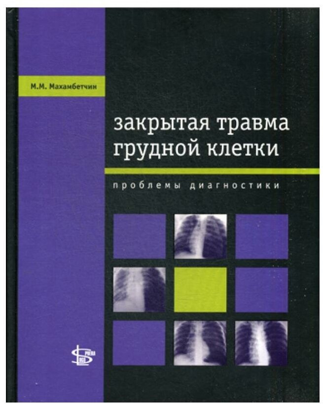 Книга Закрытая травма Грудной клетки - фото №1