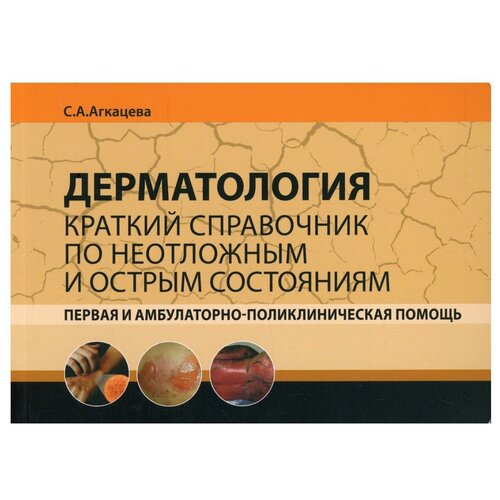 Агкацева С. А. Дерматология. Краткий справочник по неотложным и острым состояниям