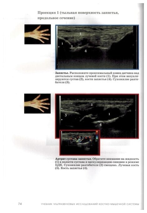 Книга Учебник ультразвуковых исследований костно-мышечной системы - фото №3