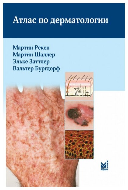 Книга Атлас по дерматологии (Рекен Мартин) - фото №2